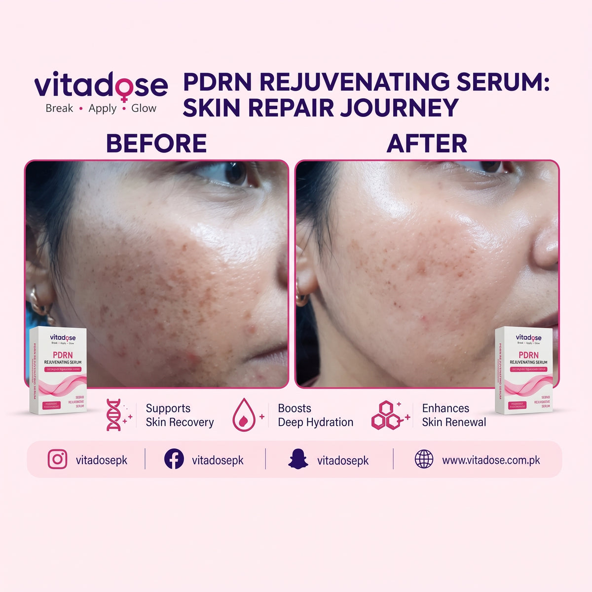 PDRN Rejuvenating Serum