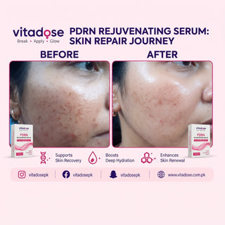 PDRN Rejuvenating Serum